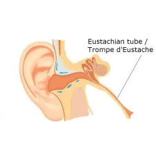Ear infections