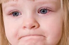 Pinkeye (Conjunctivitis)